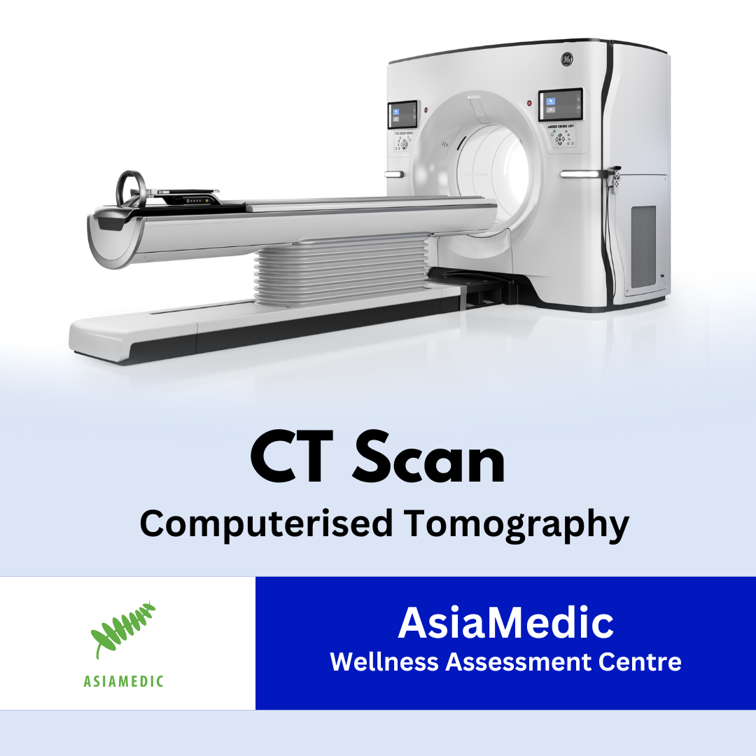 Computerised Tomography (CT Scan) - AsiaMedic