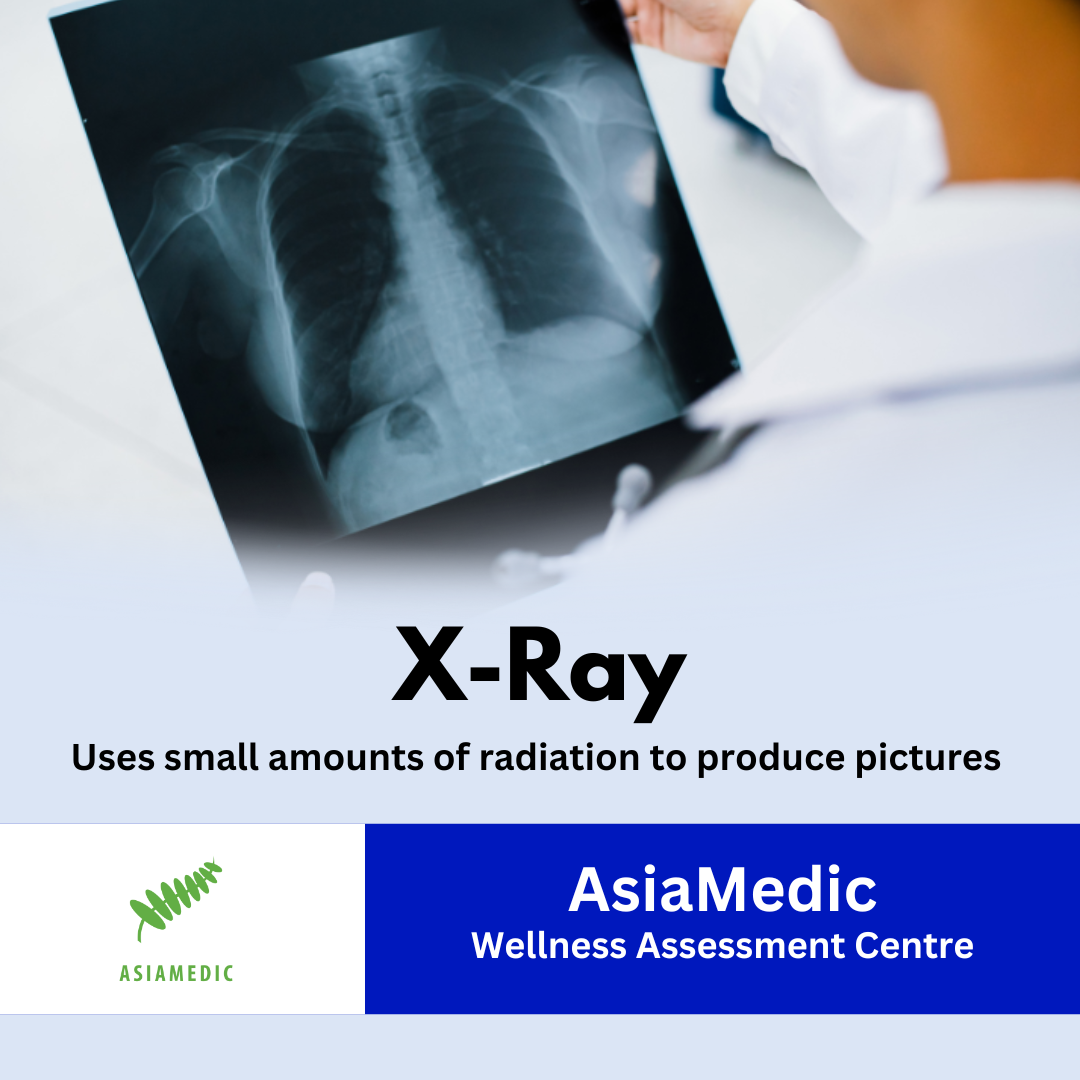 AsiaMedic X Ray package